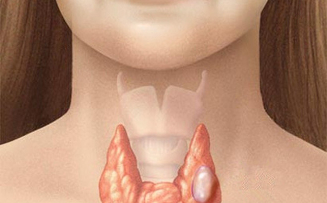 Nhân giáp - Hình ảnh minh họa